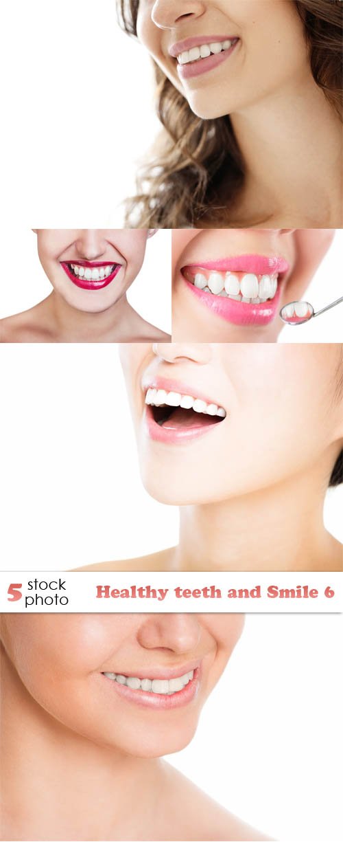 Photos - Healthy teeth and Smile 6